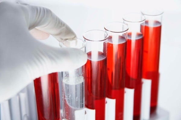 Анализ крови на гормоны - норма, расшифровка 